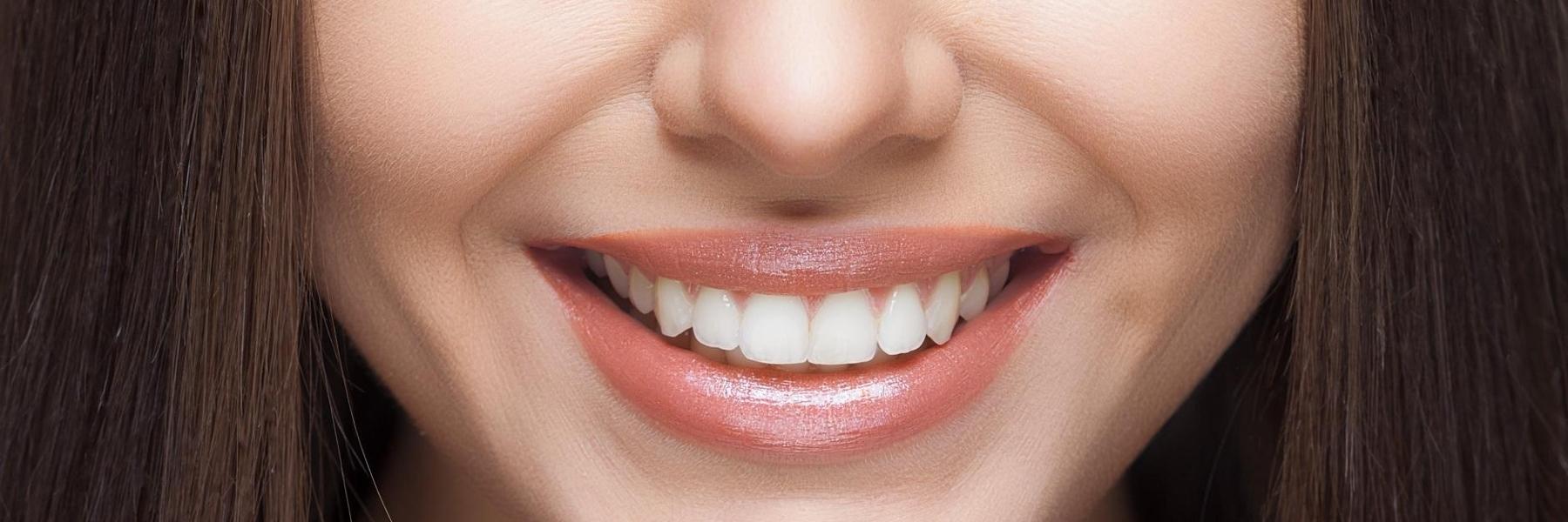 Things You Should Know Before Getting Veneers Cosmetic Dentistry Van