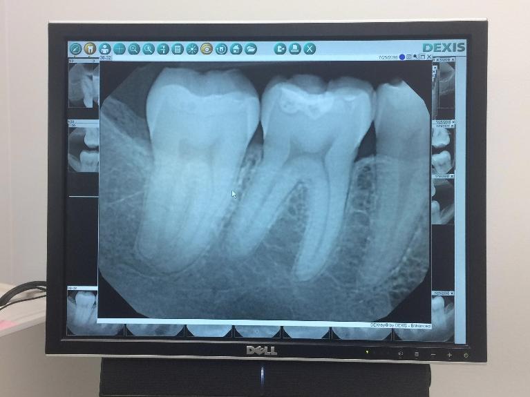 Dental Technology in Van Nuys | Digital X-Rays